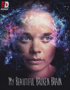 مشاهدة شاهد اونلاين فيلم My Beautiful Broken Brain 2014 مترجم