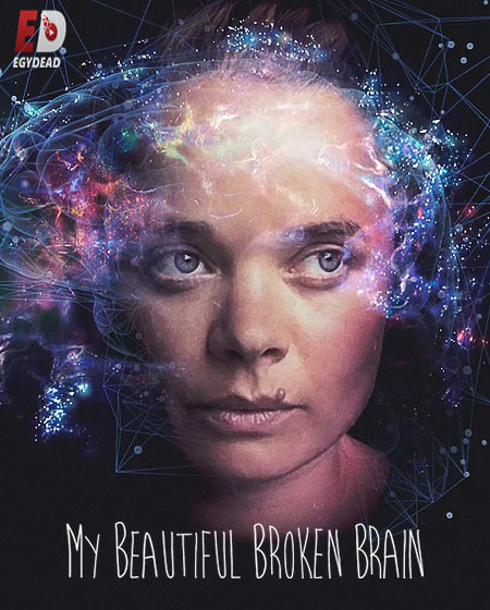 مشاهدة شاهد اونلاين فيلم My Beautiful Broken Brain 2014 مترجم